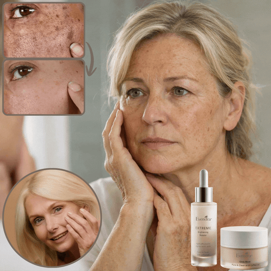 Evendra™ Night Cream For Age Spots | Remove Dark Spots 93% in 72 Hours!