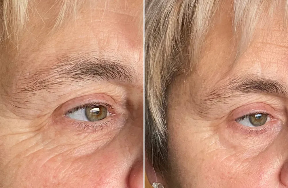 Customer before and after results