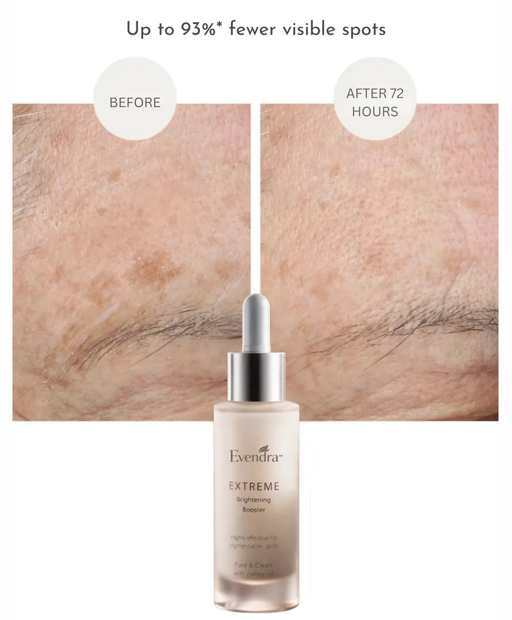 Before and after: up to 93% fewer visible spots